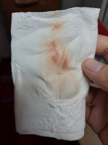 Blood Alert !