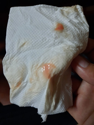 Am I in Labor ?