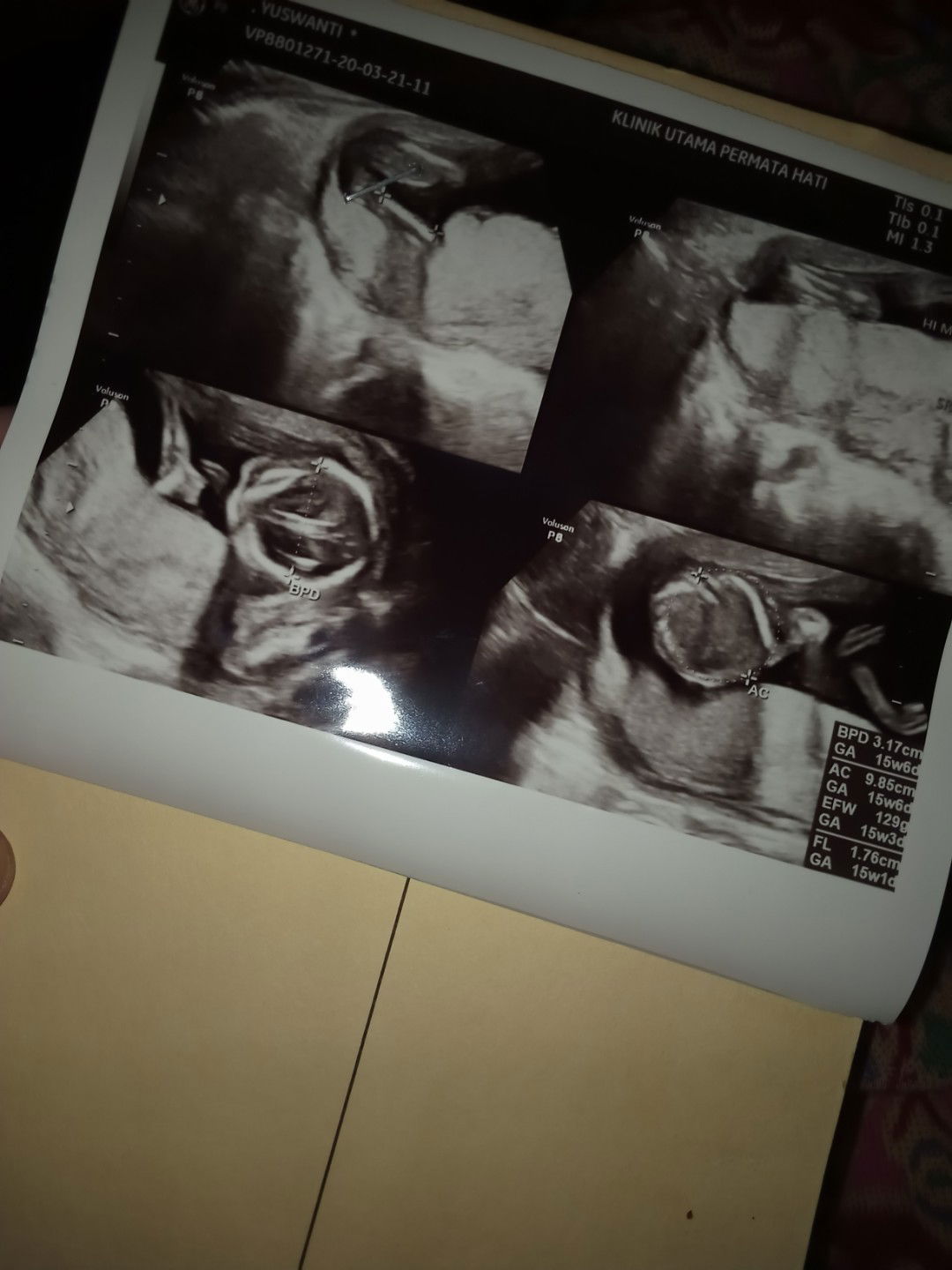 Hitungan usia kandungan