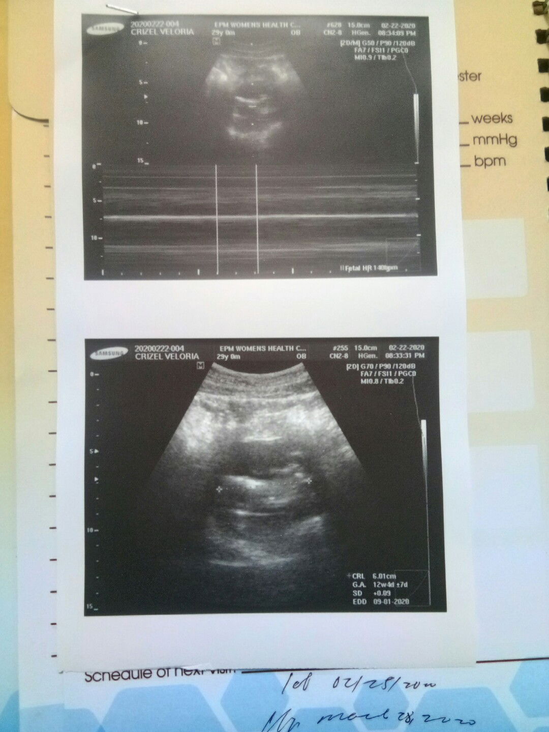 12 weeks pero mababa pa din si baby