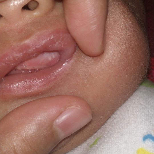 gusi bayi ada putih2 nya