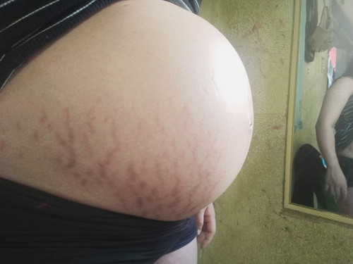 35Weeks
