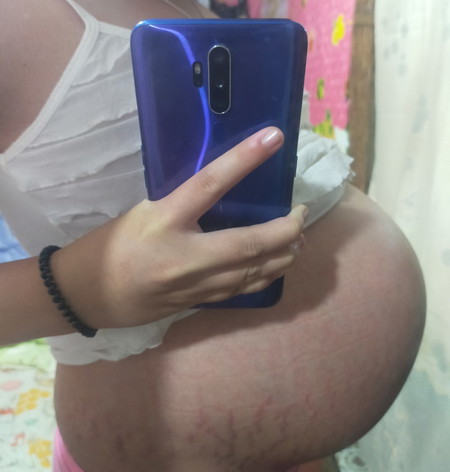 @38 weeks Okay lang po ba tummy ko?