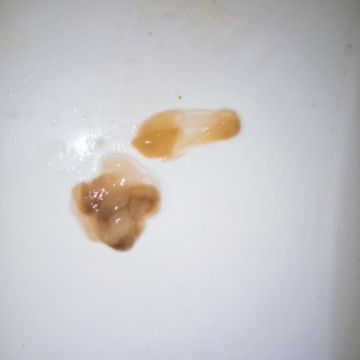 cho e biết ý kiến giúp ạ