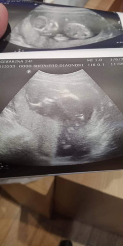 normal lang ba na sa 15weeks andyan tlaga legs ni baby?