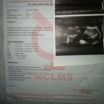 ultrasound