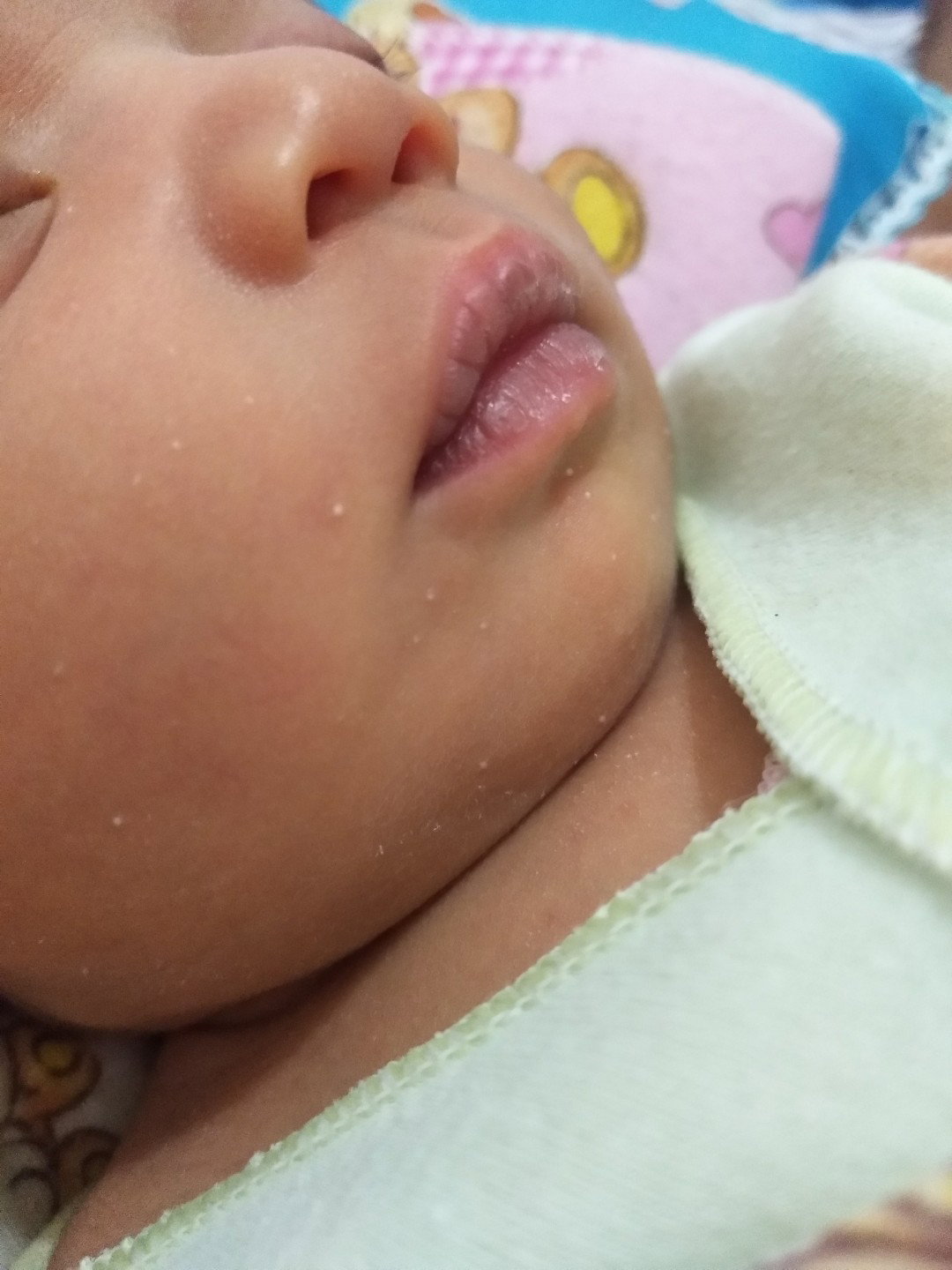 Bintik putih di pipi bayi