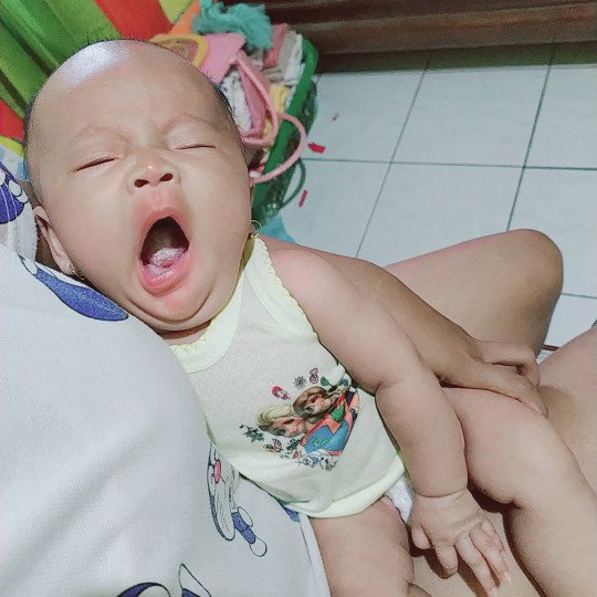 cara menghilangkan mlepuh bekas sufor