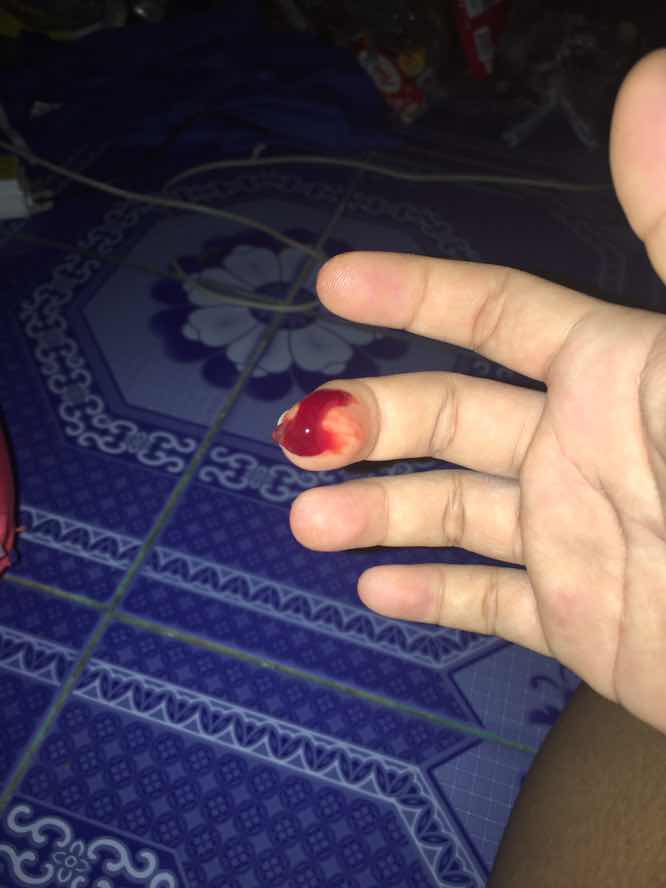 โดนกระตุ้นเร่งคลอด กวาดปากมดลูก