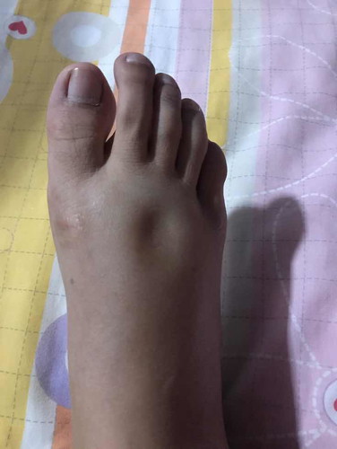 แม่คนไหนเท้าบวม