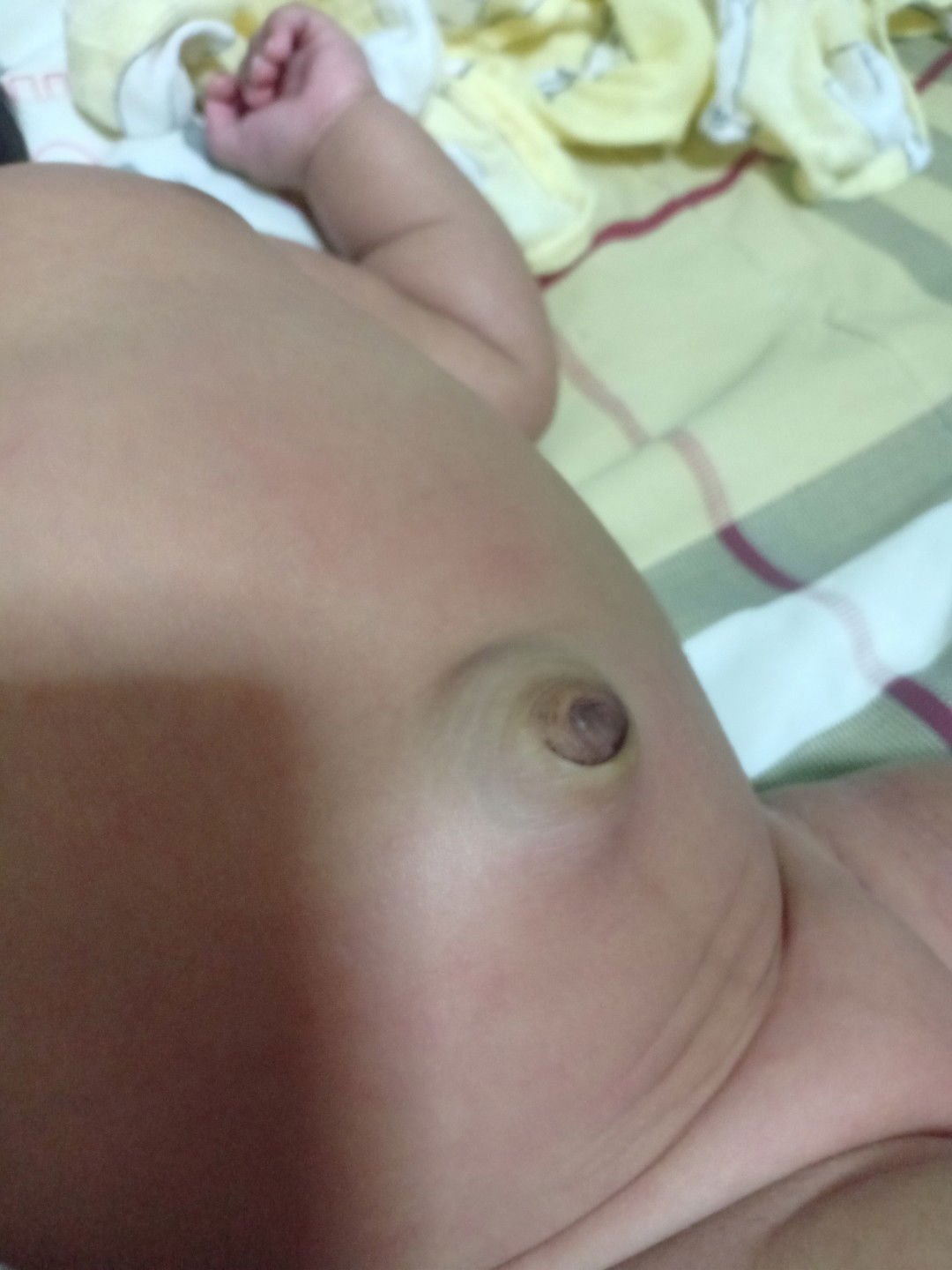 สะดือผิดปกติไหมคะ