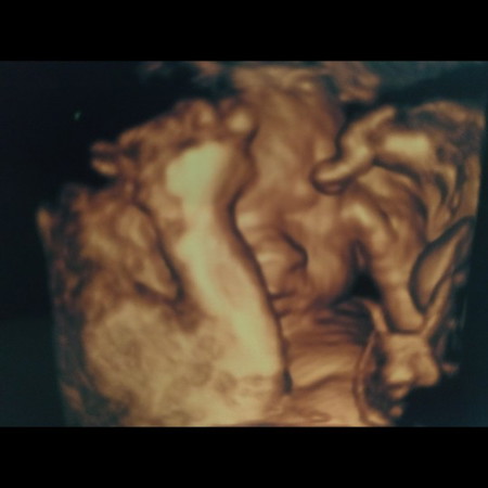 adakah yang sudah usg 4d bun?baby nya malu2 ? uk 28w