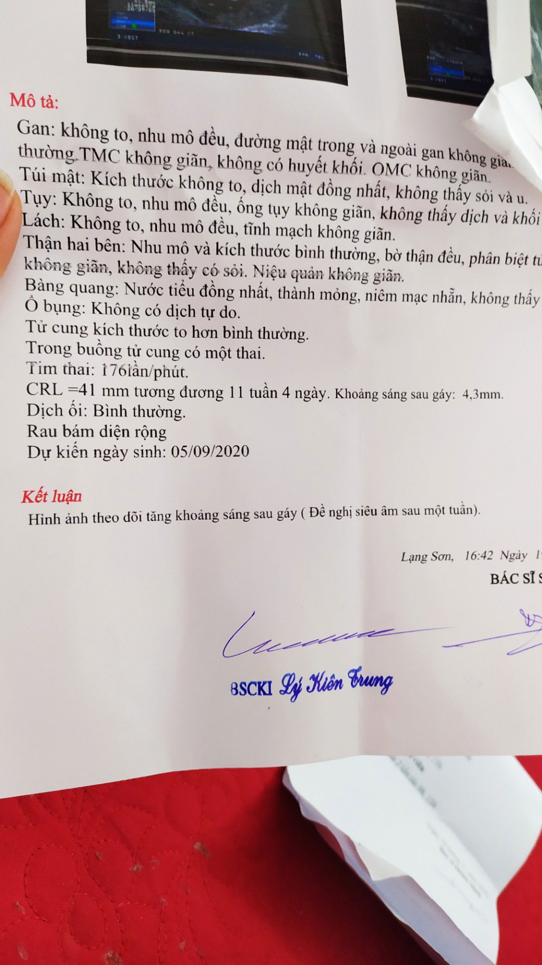 khoảng sáng sau gáy