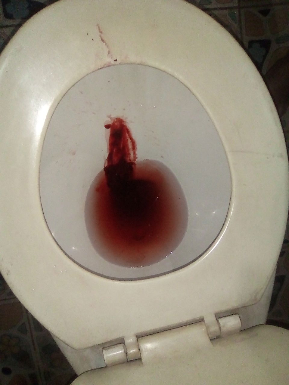 มีเลือดออก