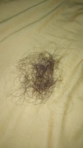 Rambut Rontok