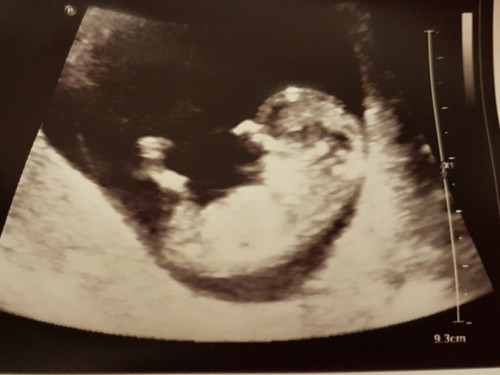 อยากทราบเพศแล้วววว