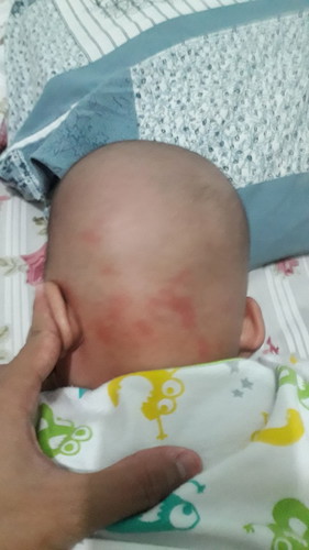 adakah yg pernah mengalami ini