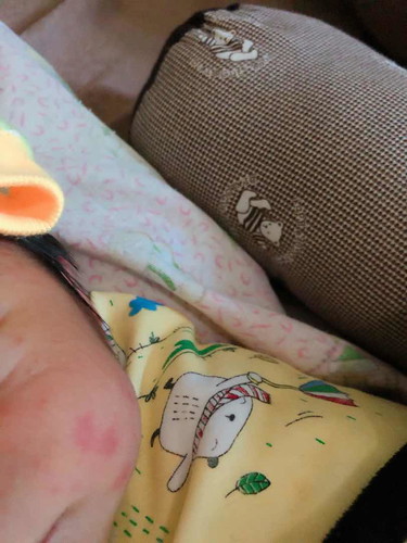 Bun mau nanya anak saya mukanya pada merah” kenapa ya bun ada yang tau kah?