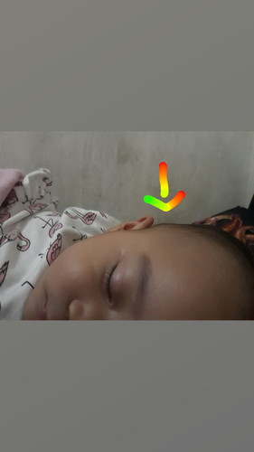 BUKOL?