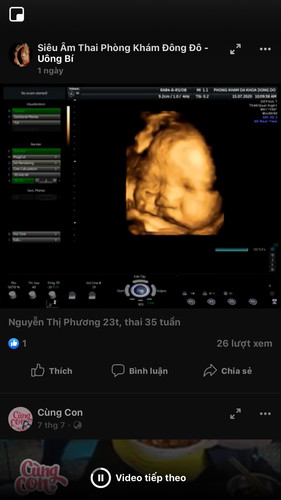 Có mom nào thai từ tuần 36 trơ đi k tăng cân nữa k ak? E lo quá.