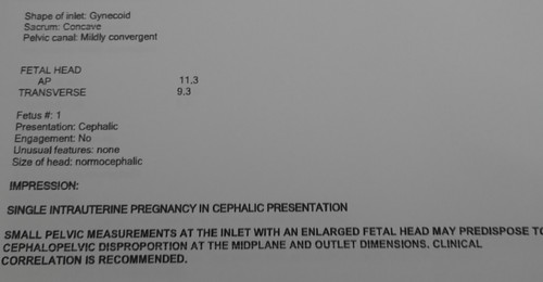 Pelvimetry Result