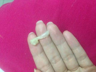 5 months pregnant/Discharge