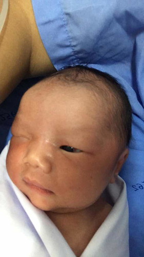 แอบแตกก่อนกำหนด