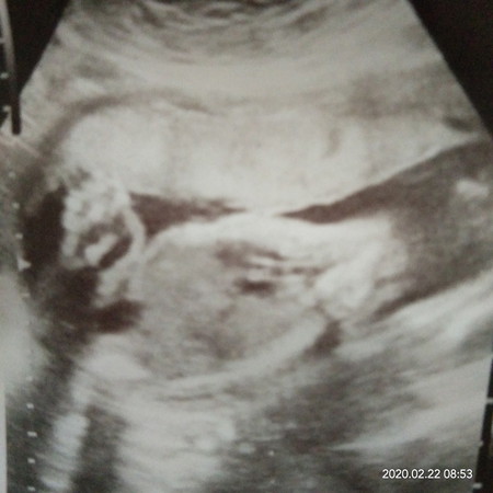 boy or girl?