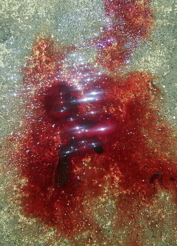 Blighted ovum