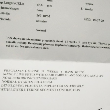 early pregnancy contractions