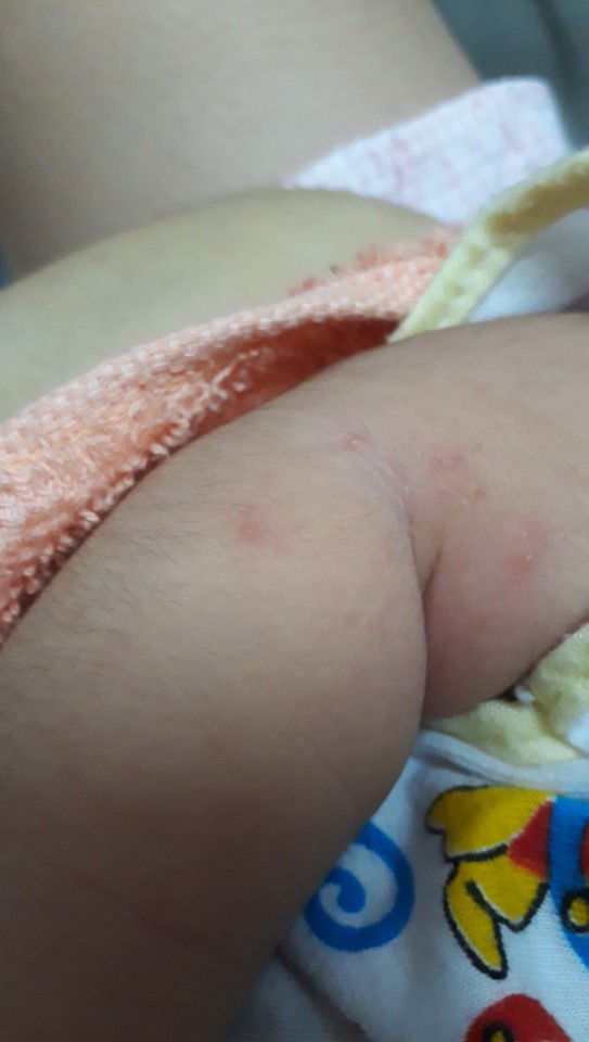 sức khỏe trẻ sơ sinh tháng đầu