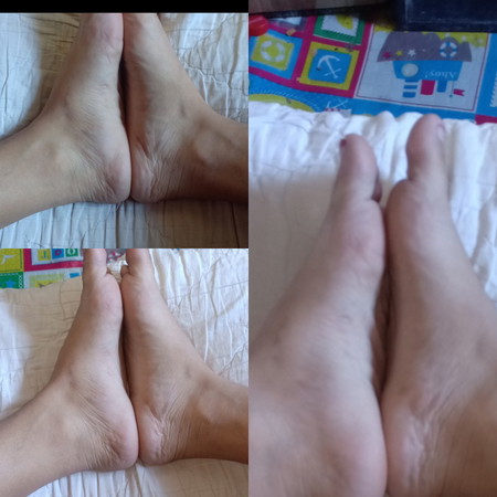 REFLEXOLOGY TEST