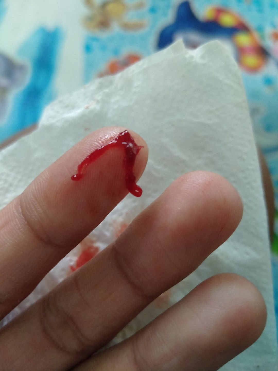 ใครเคยเป็นแบบนี้บ้างคะ???