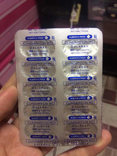 Sakit sa dibdib