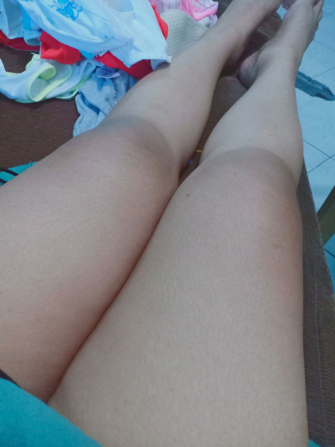 Post Partum Eclamsia