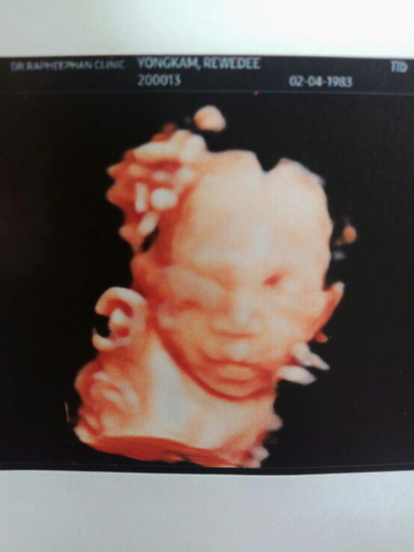 ครบ24wแล้วจ้า