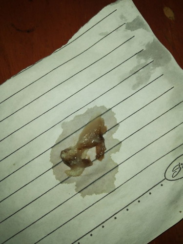 Mucus Plug?