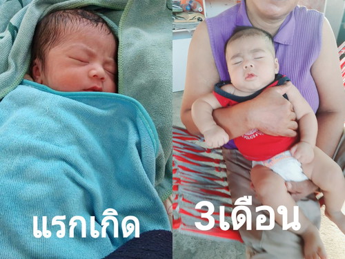 แรกเกิดvsตอน3เดือน