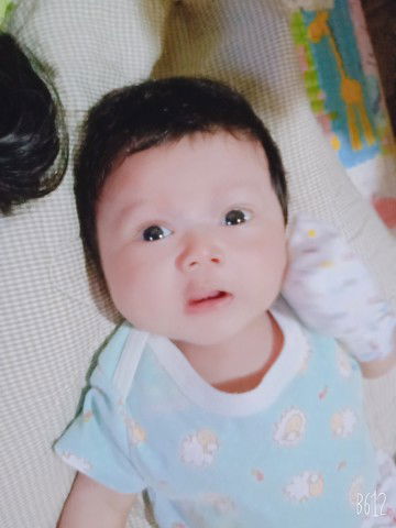 noda putih pada lidah