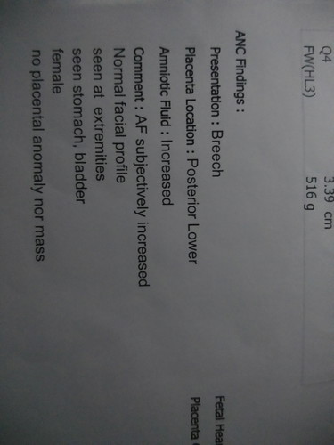 อยากทราบเพศลูก