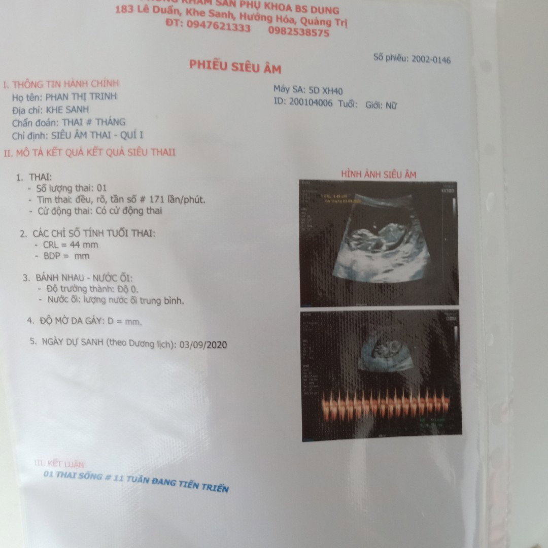 các mẹ ơi nhịp tim 171 có phải con gái k ạ??