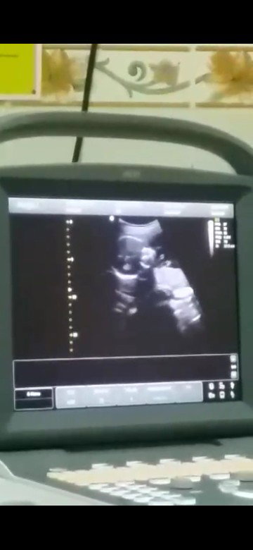 baby yang aktif