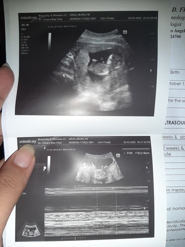 13bweeks and 3 days