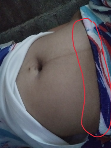 ตั้งครรห์ได้ 19w3d