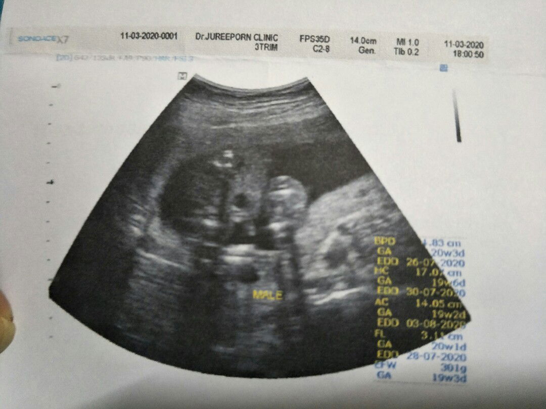 ดาวูดครับ