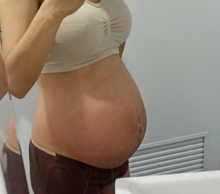 35 week ท้องแบบนี้เริ่มท้องลดรึยังคะ