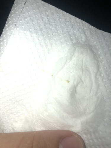 Need help and advice.