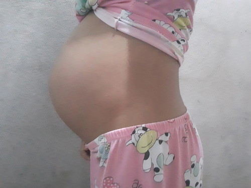 37+6w ท้องเล็กไปไหมคะ