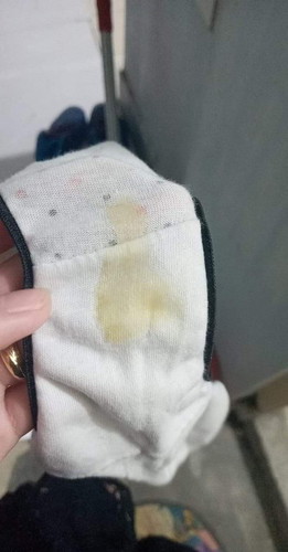 yellow discharge