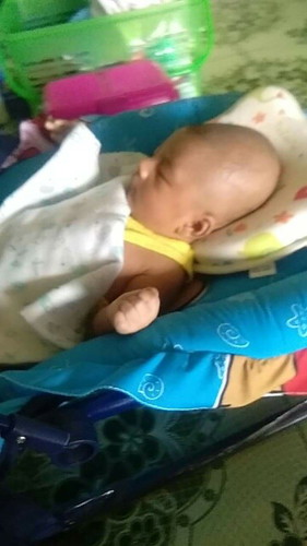 น้องหัวยาว/หัวแบน